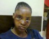 Sad! Girl reveals how her boyfriend battered her brutally with pic evidence