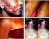 SHOCKING Pictures OF What ‘Bleaching’ Did To Some African Women