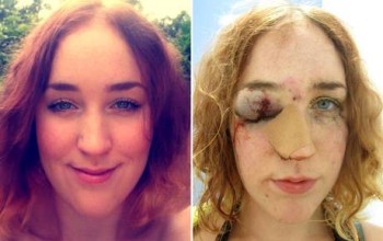 Woman Shares Horrific Selfie After Being Punched In The Face By Man For Telling Him Off