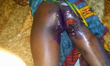 The Concluding Update of the girl whose madam forced her to sit on a burning electric cooker