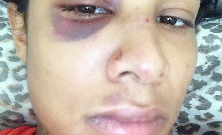 Model Danii Phae shares pics of battered face after attack by rapper bf