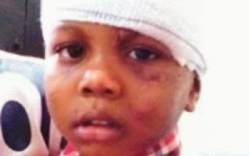 OMG! See what those dogs did to little Omonigho Abraham [Photo]