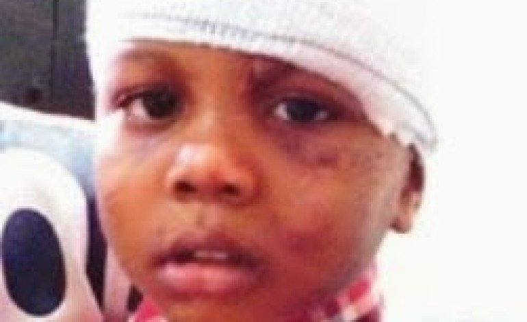 OMG! See what those dogs did to little Omonigho Abraham [Photo]