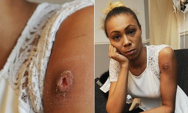 Mystery spider attack leaves woman, 21, with paralysed arm after being bitten in her sleep