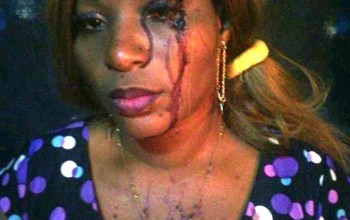 Photos: Woman brutally beaten by husband for allegedly greeting her pastor