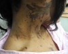 Jealous Housewife Attacks Rival With Acid, READ What She Did To Herself