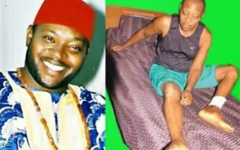 SO SAD: Another Popular Nollywood Actor Is Dying, Recounts Horrible Ordeal
