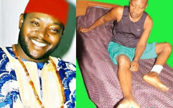 Nollywood Actor, Prince James Uche Pleads With Nigerians For Financial Assistance As He Battles Diabetes And Hypertension