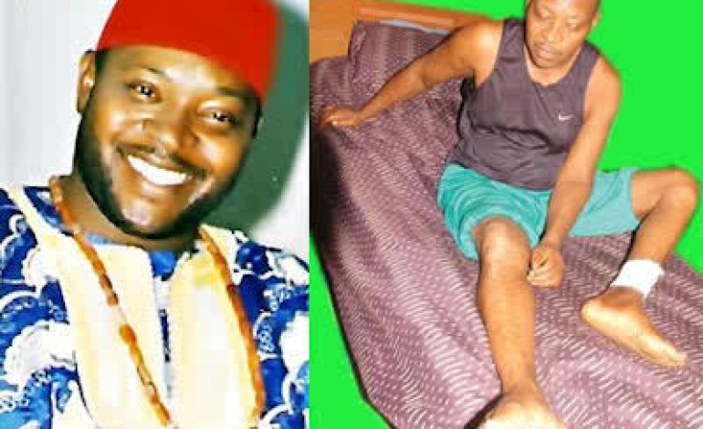 Nollywood Actor, Prince James Uche Pleads With Nigerians For Financial Assistance As He Battles Diabetes And Hypertension