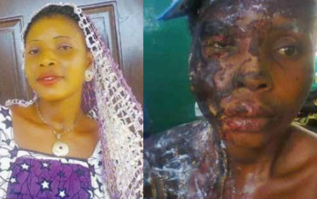 #Domestic #Violence: Man baths ex-lover with acid in Kogi state