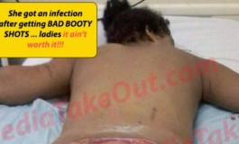 Not Good! Woman gets deadly infection after getting bad booty shots