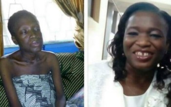 Woman Who Suffered Wrong Operation Cries Out: I've Sold All I Had, Including My Wedding Ring, To Stay Alive