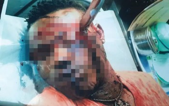 Shocking!  Lagos hoodlums stab LAWMA worker in the eye in revenge