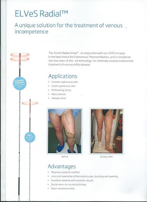 How well and what exactly you should know about Varicose veins