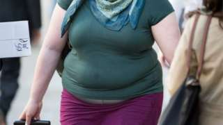 Obese patients may face NHS surgery ban to save money