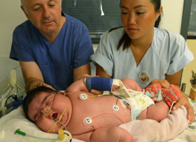 Huge baby girl Jasleen born in Germany. Her size is terrific!