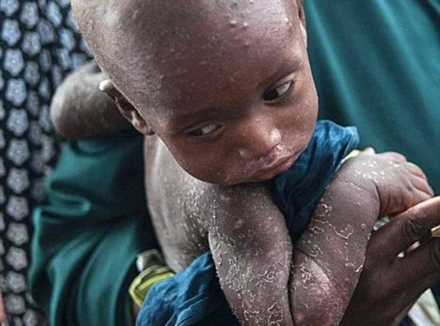 REVEALED! How SGF Lawal Babachir is aiding starvation among IDPs